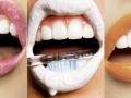 How to: bleach your teeth